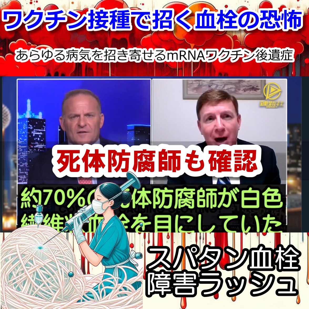 新型コロナワクチン接種後に奇妙な血栓を2021年から死体防腐師が確認